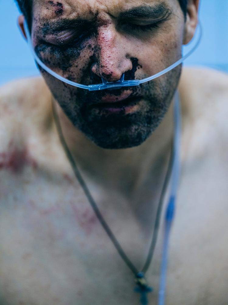 ‘What kind of dreams is he seeing?’ … a wounded soldier receiving treatment.