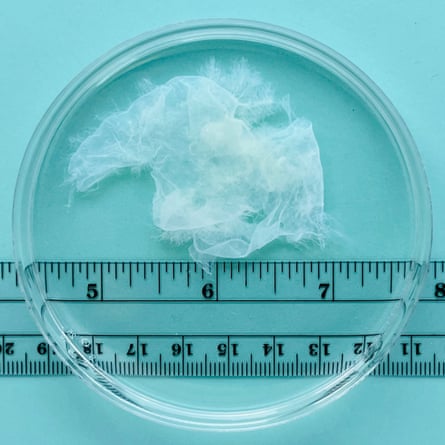 medium amount of whitish material in petri dish