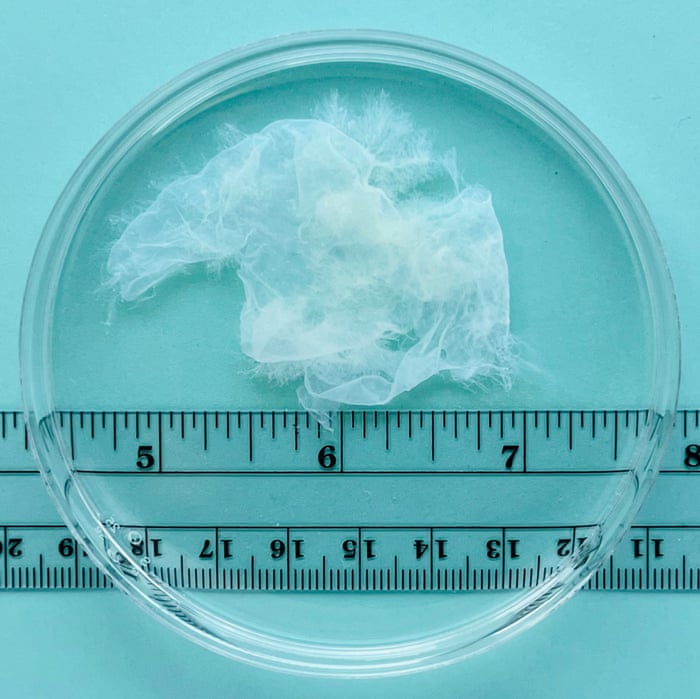 Abortion Pictures 4 Weeks abortion-pictures-4-weeks
