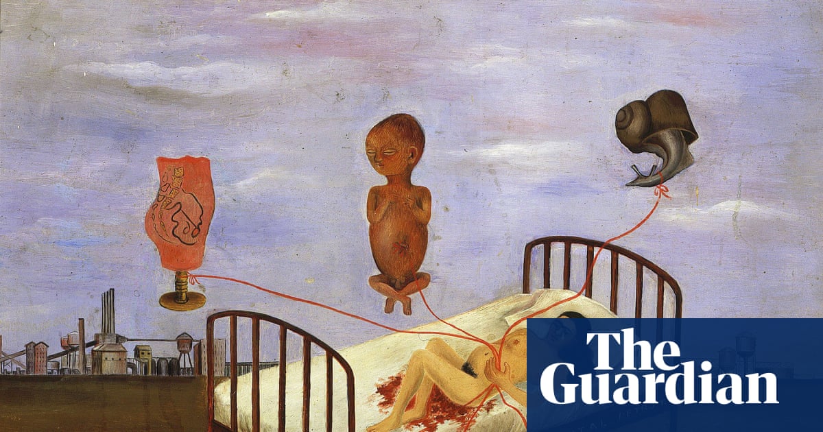 This is mine, I own it': how Tracey Emin and Frida Kahlo inspired me to make meaning out of pain