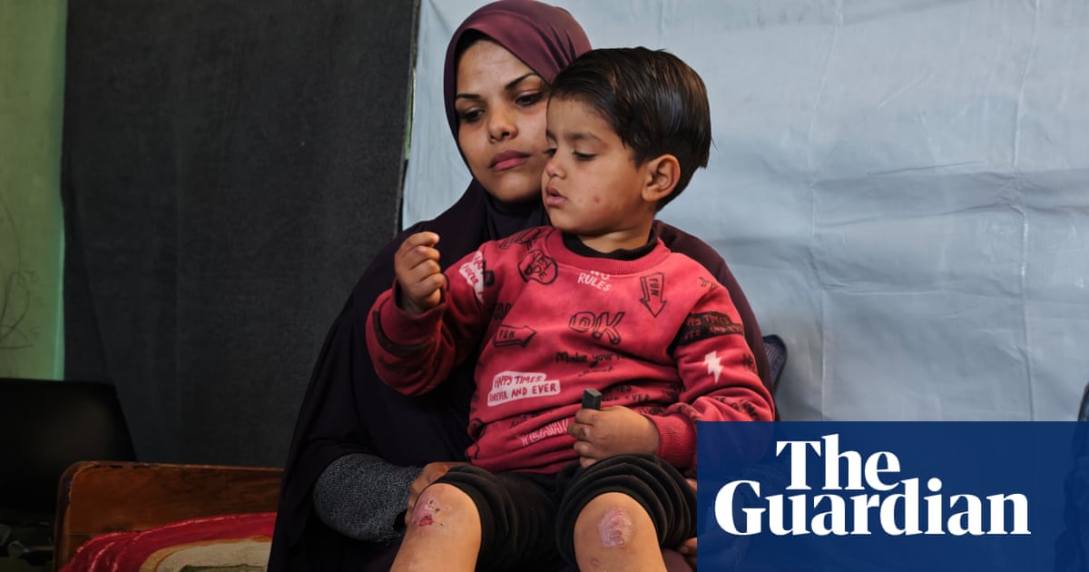 I wish I had the power to ease his suffering': Gaza's cancer patients trapped by war and blockade