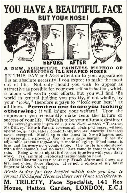 Advertisement for a nose-shaping device, 1923.