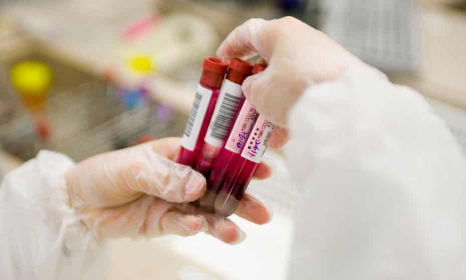 A doctor holding blood samples