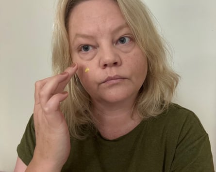 The writer applying a cream to her face