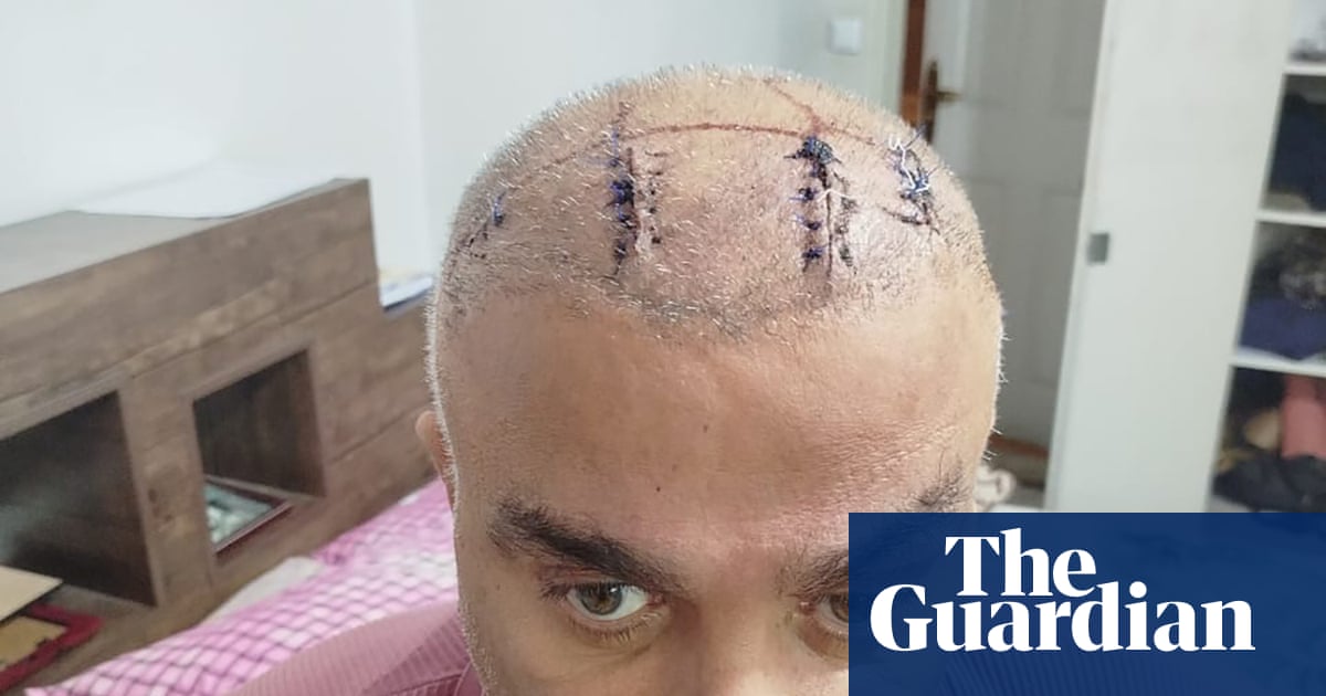 ‘They beat me until I lost consciousness’: growing reports of brutal arrests, torture and deaths in Iran’s prisons