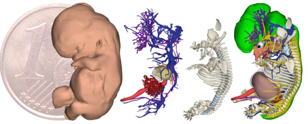 3D reconstructions of a human embryo at 9.5 pregnancy weeks (15.9 mm in length). From left to right the skin, cardiovascular system, skeleton and organs.