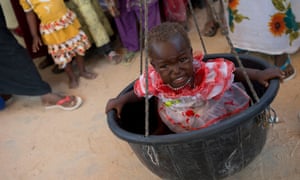 Stunting affects tens of millions of children worldwide