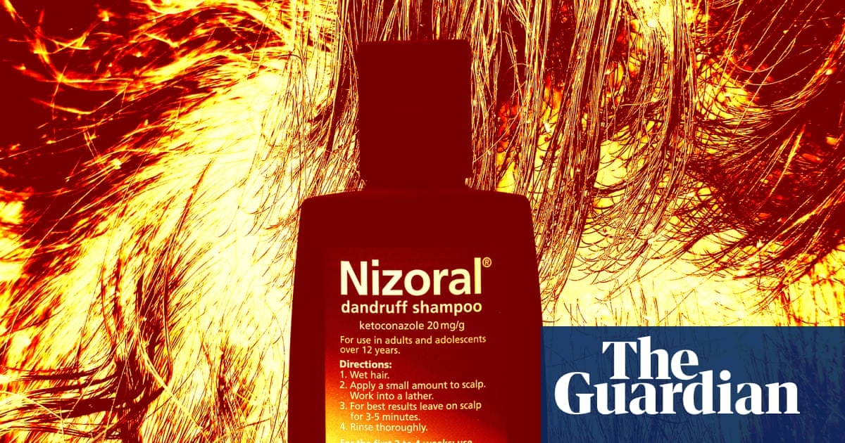 Not glamorous, but common: how to manage dandruff at home and when to get help