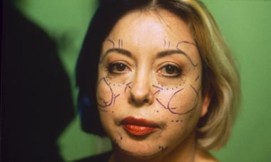 ORLAN before the cosmetic surgery operation she broadcast to galleries worldwide.