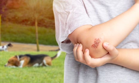 A young child holds their arm, showing a scab