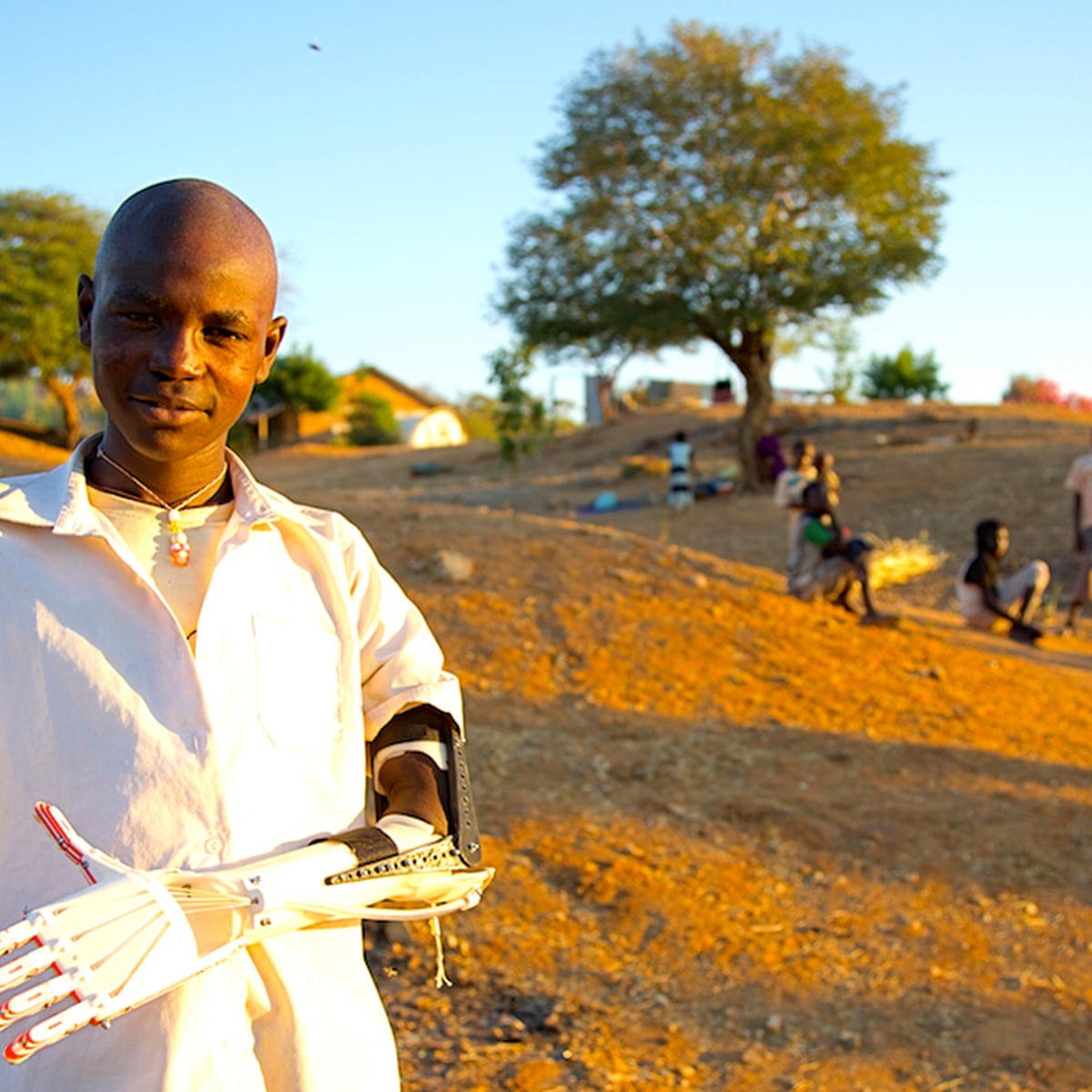 3d Printed Prosthetic Limbs The Next Revolution In Medicine