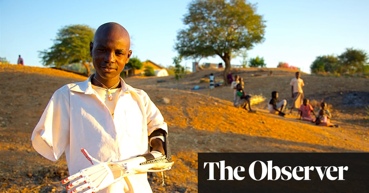 3d Printed Prosthetic Limbs The Next Revolution In Medicine Technology The Guardian