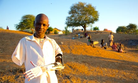 Daniel Omar, 14, with his 3D-printed prosthetic arm.
