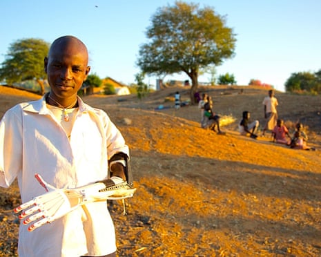 A charity uses 3D printers to make prosthetic limbs for children injured in war in Africa, such as Daniel, pictured