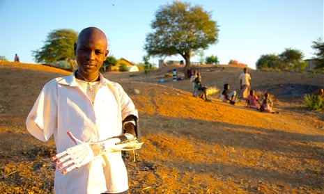 A charity uses 3D printers to make prosthetic limbs for children injured in war in Africa, such as Daniel, pictured
