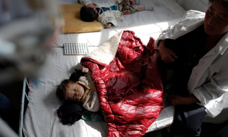 North Korean children suffering from malnutrition rest in a hospital in Haeju. 