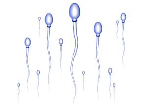 Sperm cells on their way to the egg