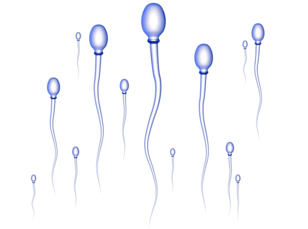 Sperm cells on their way to the egg.