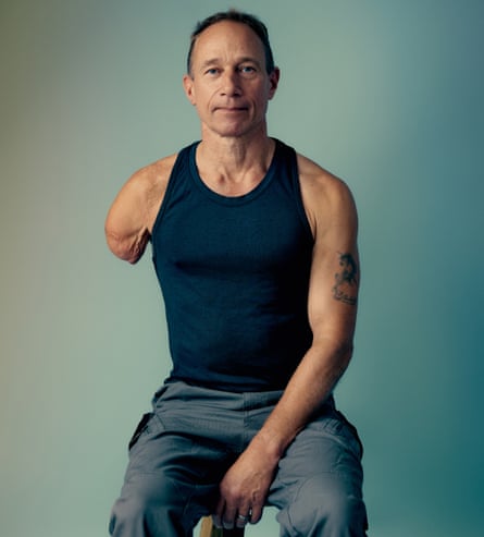 Jim Ashworth-Beaumont photographed earlier nan fitting of his manually adapted prosthetic limb successful October 2024