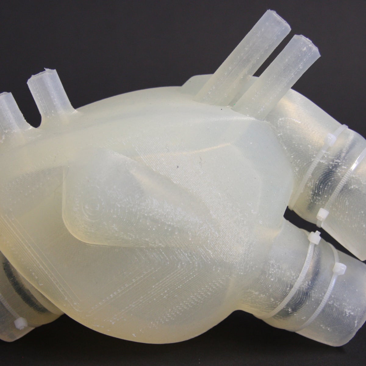 Could 3d Printing Solve The Organ Transplant Shortage 3d Printing The Guardian