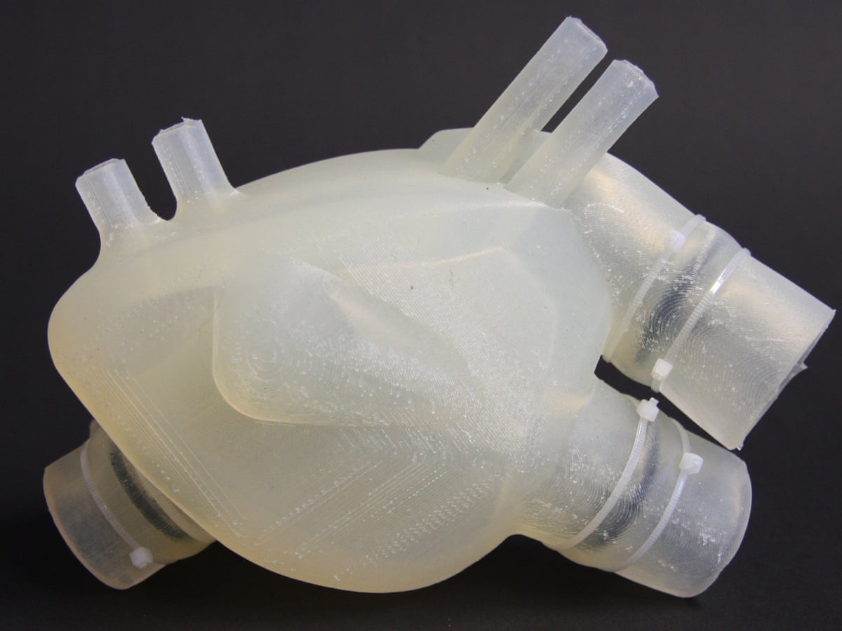 Could 3d Printing Solve The Organ Transplant Shortage
