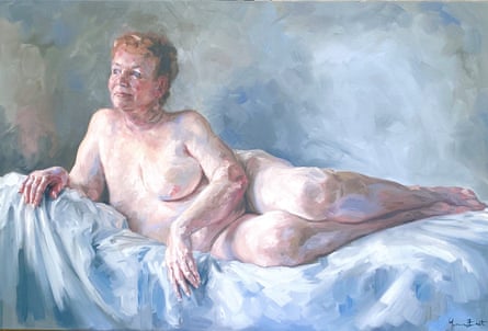A nude woman with short hair and a mastectomy scar lays on a white sheet 