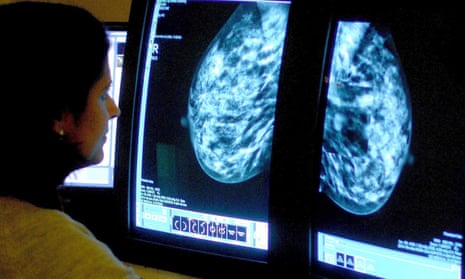 Ribociclib may boost outcomes for patients with much earlier-stage breast cancer than previously shown.