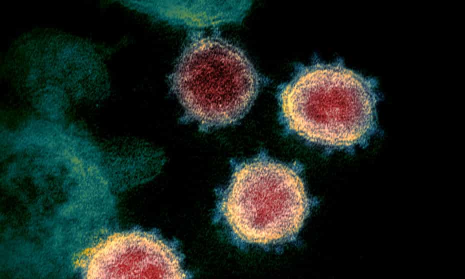 up to 90 volunteers in uk to take part in pioneering covid infection trial coronavirus the guardian up to 90 volunteers in uk to take part in pioneering covid infection trial coronavirus the guardian