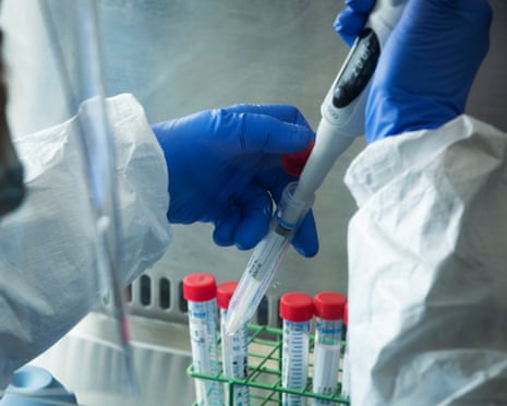 Covid 19 test samples being processedBritt Tye, normally a quality control scientist seen here with Coronavirus test swabs being processed at Censo Biotechnologies laboratory. She is extracting RNA from the samples as the first step in the testing process.
Censo Biotechnologies, is a specialist biotech company and spin off from The Roslin Istitute that created Dolly the Cloned Sheep. Censo Biotechnologies has joined the COVID-19 Volunteer Testing Network, offering free coronavirus testing for GPs and other front-line health care professionals who are at significant risk both personally and as potential super-spreaders to the vulnerable community from Monday 4th May 2020, supplementing the Government’s official testing programme. They expect to have the capacity to do unto 500 tests per day with the results returned the same day.
Based in Roslin and established in 2005, Censo Biotechnologies’ research is focused on using stem cell technology to enable the discovery and development of new targeted treatments for neurodegenerative and neuroinflammatory diseases including Alzheimer’s and Motor Neurone Disease. The COVID-19 Volunteer Testing Network was launched by Mike Fischer, the entrepreneur who founded the stock photography company Alamy, and has donated an initial £1m funding to establish the project. Censo Biotechnologies a leading producer of induced Pluripotent Stem Cells (iPSCs) for drug discovery. Roslin Innovation Centre Charnock Bradley Building, The University of Edinburgh Easter Bush Campus, Edinburgh. Scotland UK 13/05/2020
© COPYRIGHT PHOTO BY MURDO MACLEOD
All Rights Reserved
Tel + 44 131 669 9659
Mobile +44 7831 504 531
Email: m@murdophoto.com
STANDARD TERMS AND CONDITIONS APPLY See details at http://www.murdophoto.com/T%26Cs.html
No syndication, no redistribution. sgealbadh, A22N6S