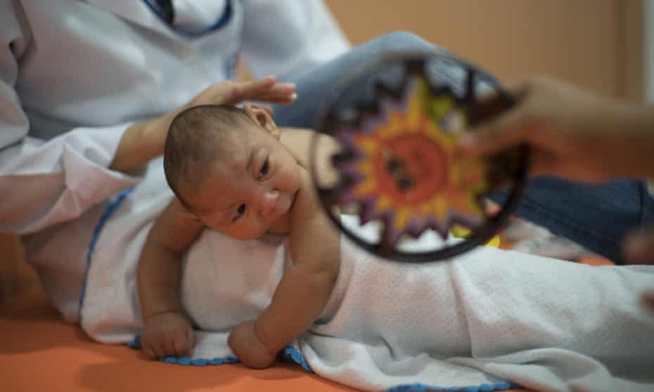 A three-month-old baby, Daniel, who was born with microcephaly, undergoes physical therapy in Recife, Brazil.
