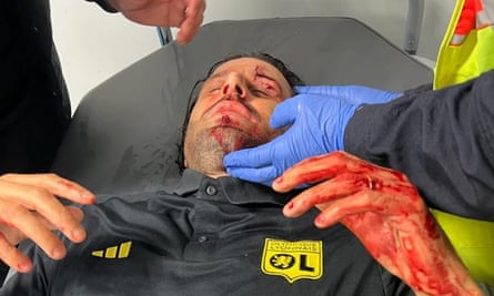 Fabio Grosso is treated for his injuries.