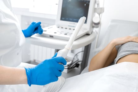 A woman holds a transvaginal ultrasound scanner with a screen in the background as a patient lies on a bed
