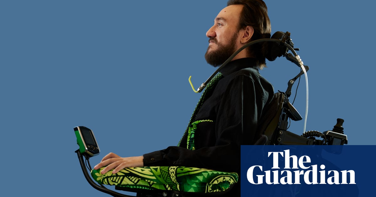 The man with Elon Musk’s chip in his brain – podcast