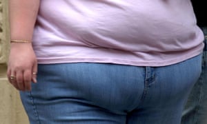 midriff of severely obese woman seen from front