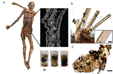 A: Ötzi and the contents of his stomach. B: Meat fibres from his stomach. C: Plant remains.