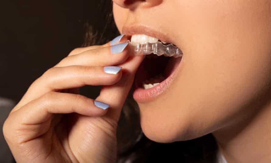 A woman putting in clear plastic braces