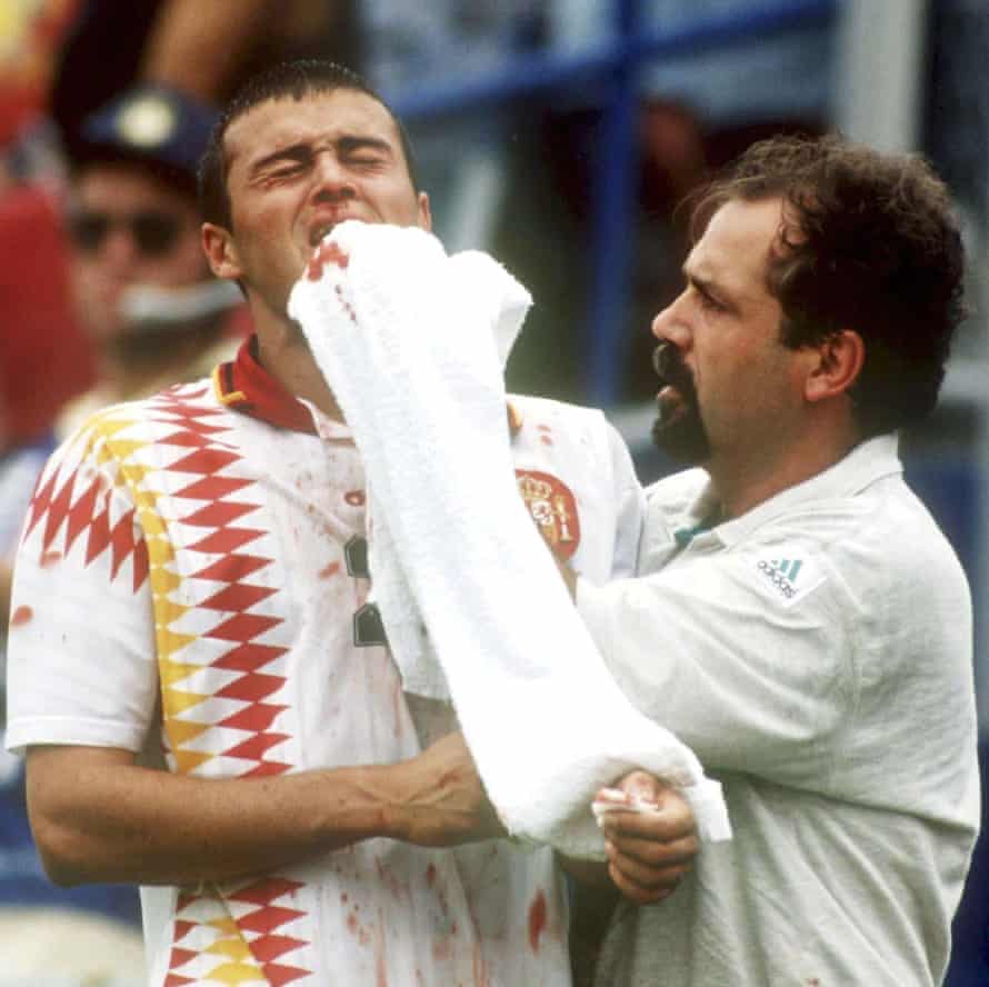 Luis Enrique broke his nose playing against Italy in the 1994 World Cup.