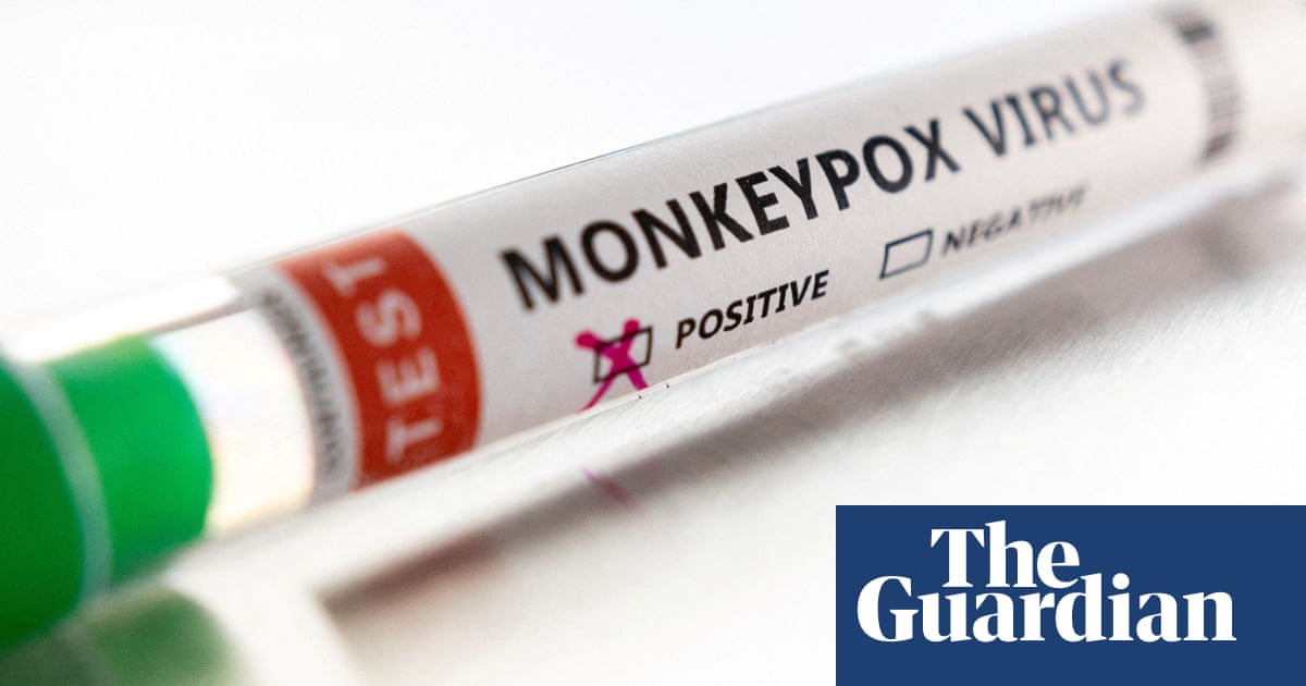 Monkeypox cases confirmed in Wales and Northern Ireland