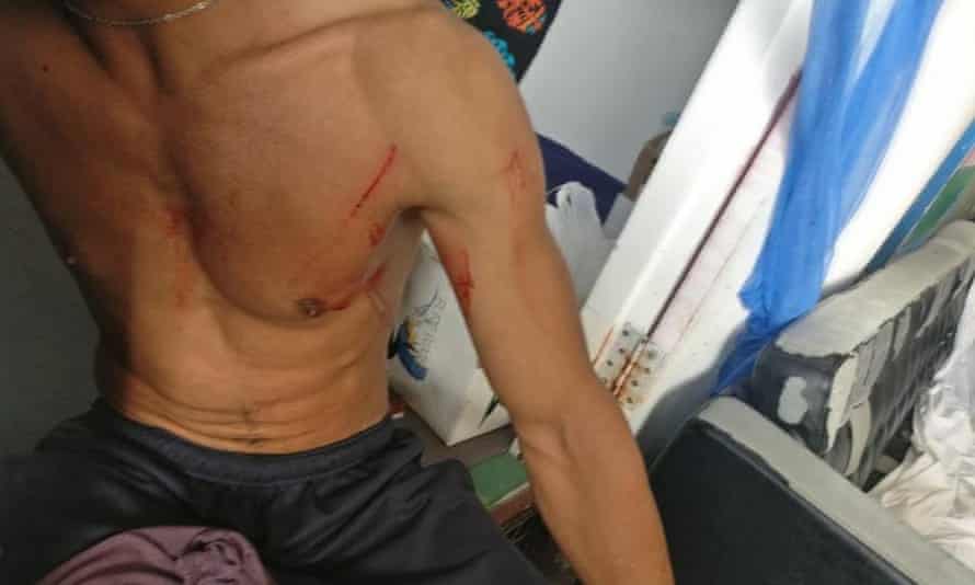 There were reported but unverified injuries sustained after the forced removal of asylum seekers on Manus Island