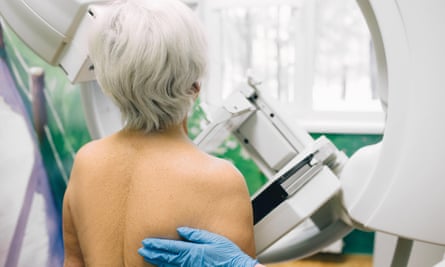 A woman having a mammography scan.