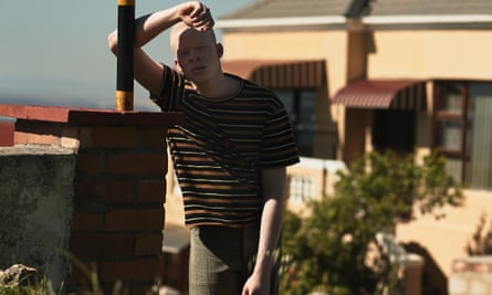 Sanele Junior Xaba: 'I take pride in my albinism' | Men's fashion | The  Guardian