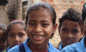Indian schoolgirl with dental fluorosis
