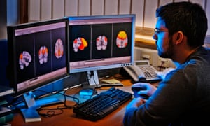 MRI and MEG scans show the networks of activity in the brain.