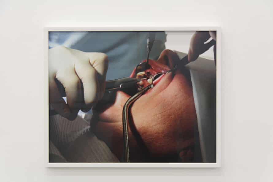 Torbjørn Rødland, Intraoral no. 2 at Manifesta 11.