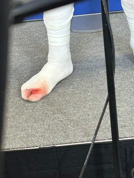 Malik Tillman displays his bloody sock aft Wednesday’s game