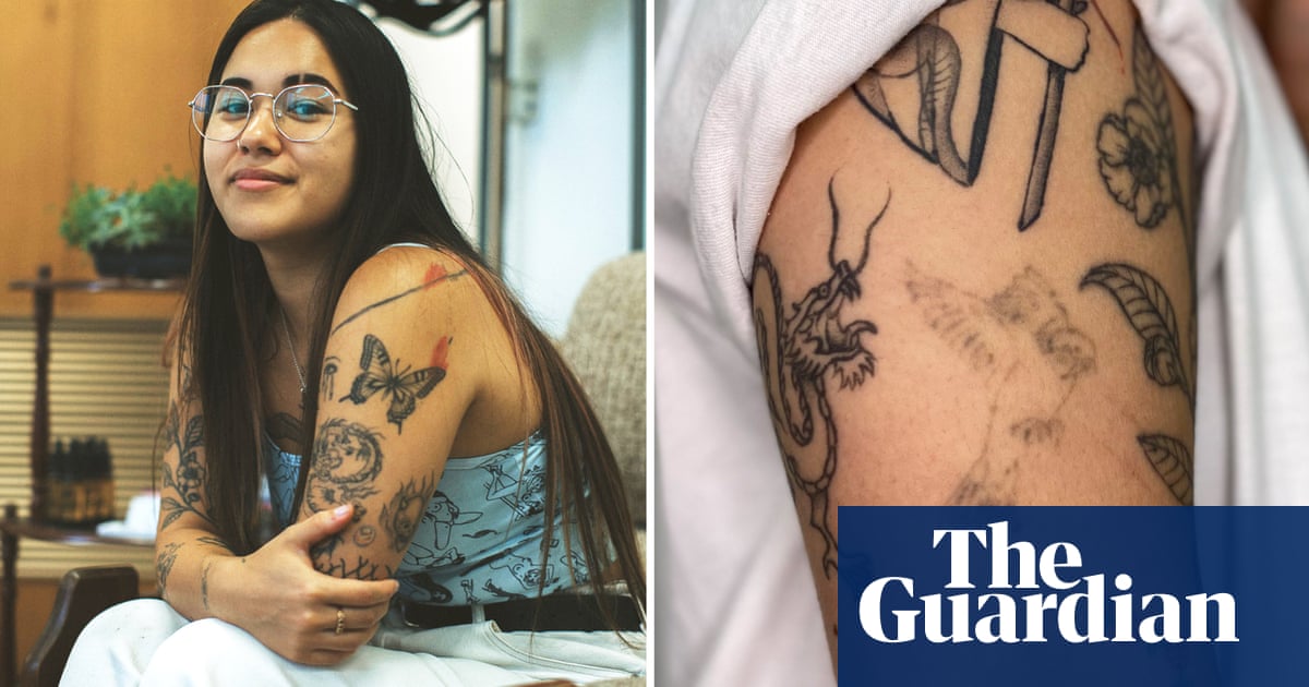 ‘I’m going to change, why can’t my body?’: tattoo removal grows up