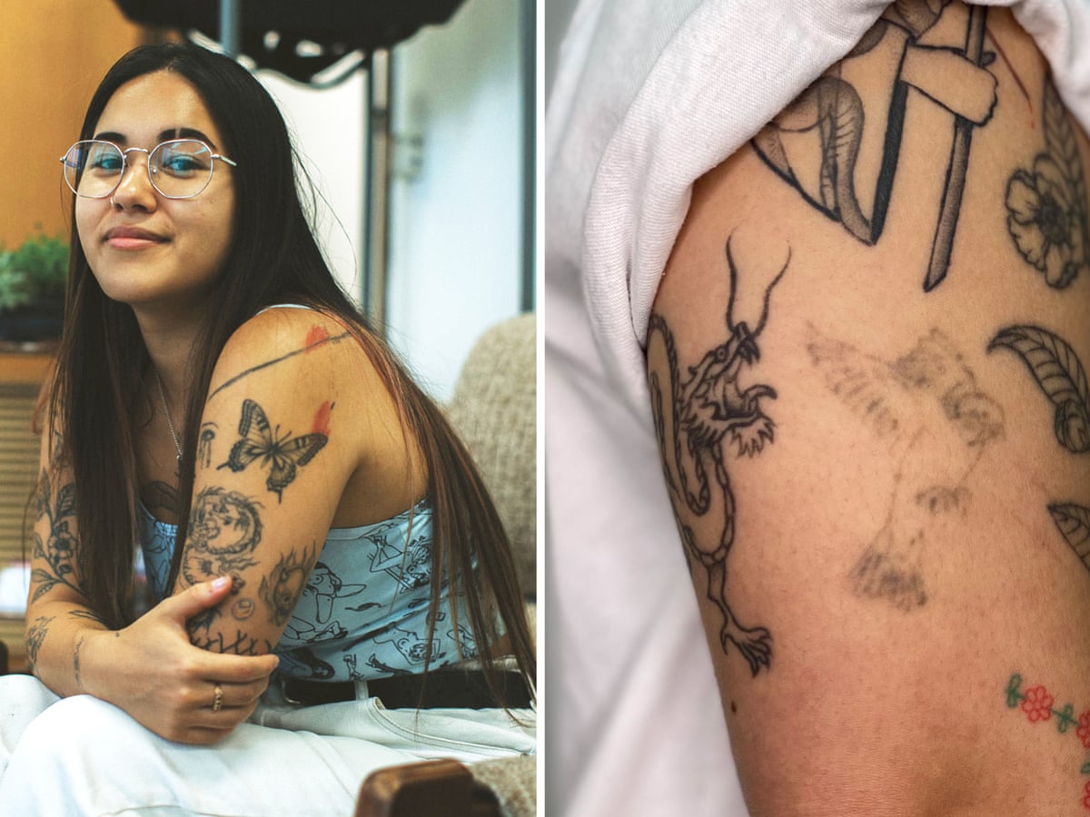 I M Going To Change Why Can T My Body Tattoo Removal Grows Up Tattoos The Guardian I M Going To Change Why Can T My Body Tattoo Removal Grows Up Tattoos The Guardian