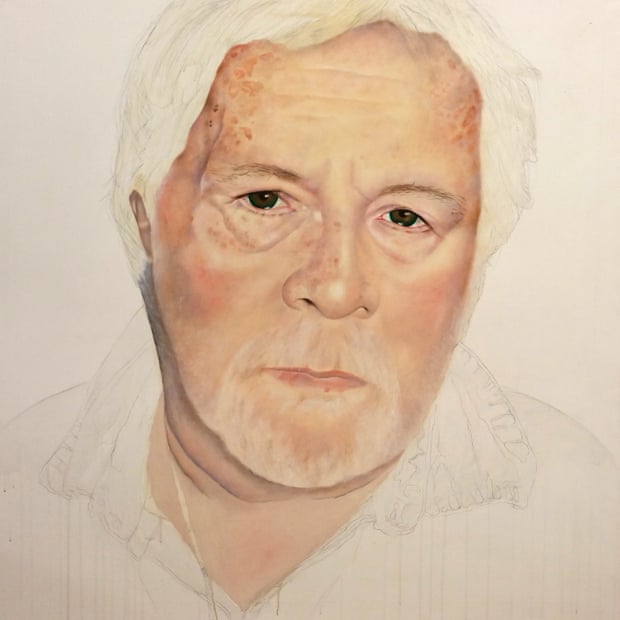 Bill Oddie in one of Andrea Tyrimos Bipolar Picasso portraits