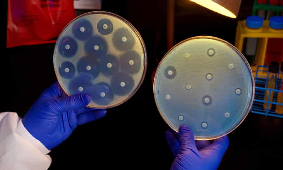 A researcher holds up two culture plates showing bacteria responses to antibiotics