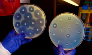A researcher holds up two culture plates growing bacteria in the presence of discs containing various antibiotics.
